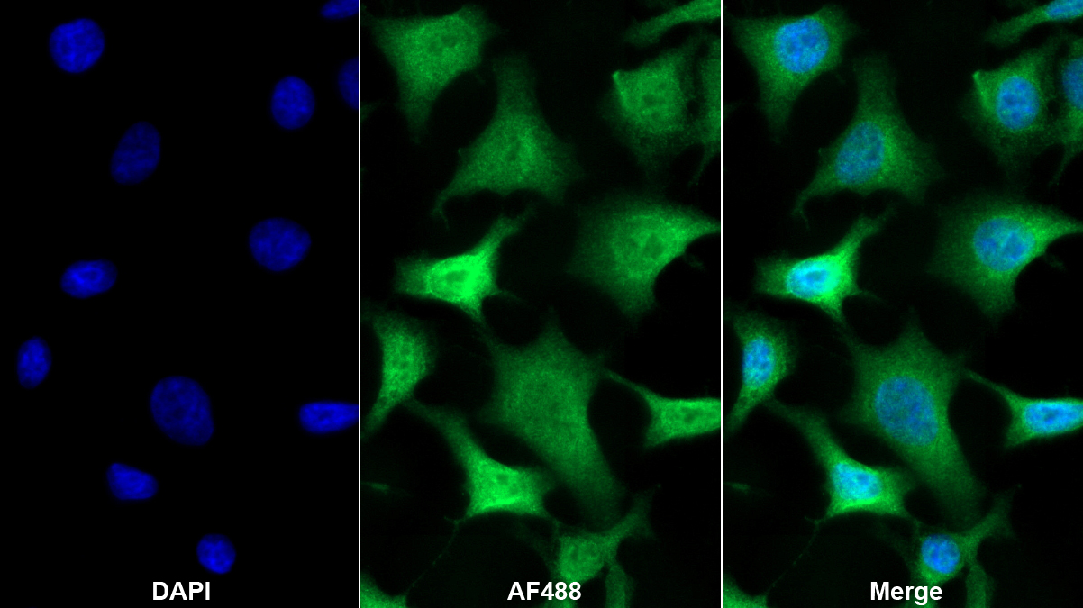 Polyclonal Antibody to Inhibitory Subunit Of NF Kappa B Alpha (IkBa)