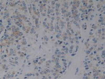 Polyclonal Antibody to Inhibitory Subunit Of NF Kappa B Beta (IkBb)