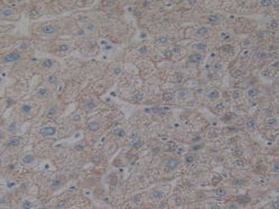 Polyclonal Antibody to Inhibitory Subunit Of NF Kappa B Beta (IkBb)