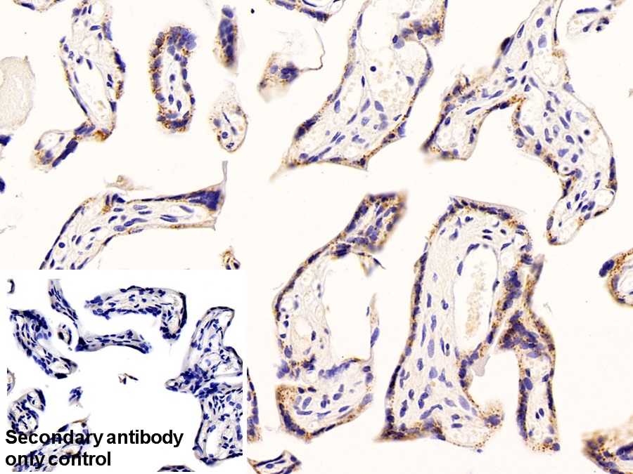 Polyclonal Antibody to Beta-1,4-Galactosyltransferase 1 (b4GALT1)