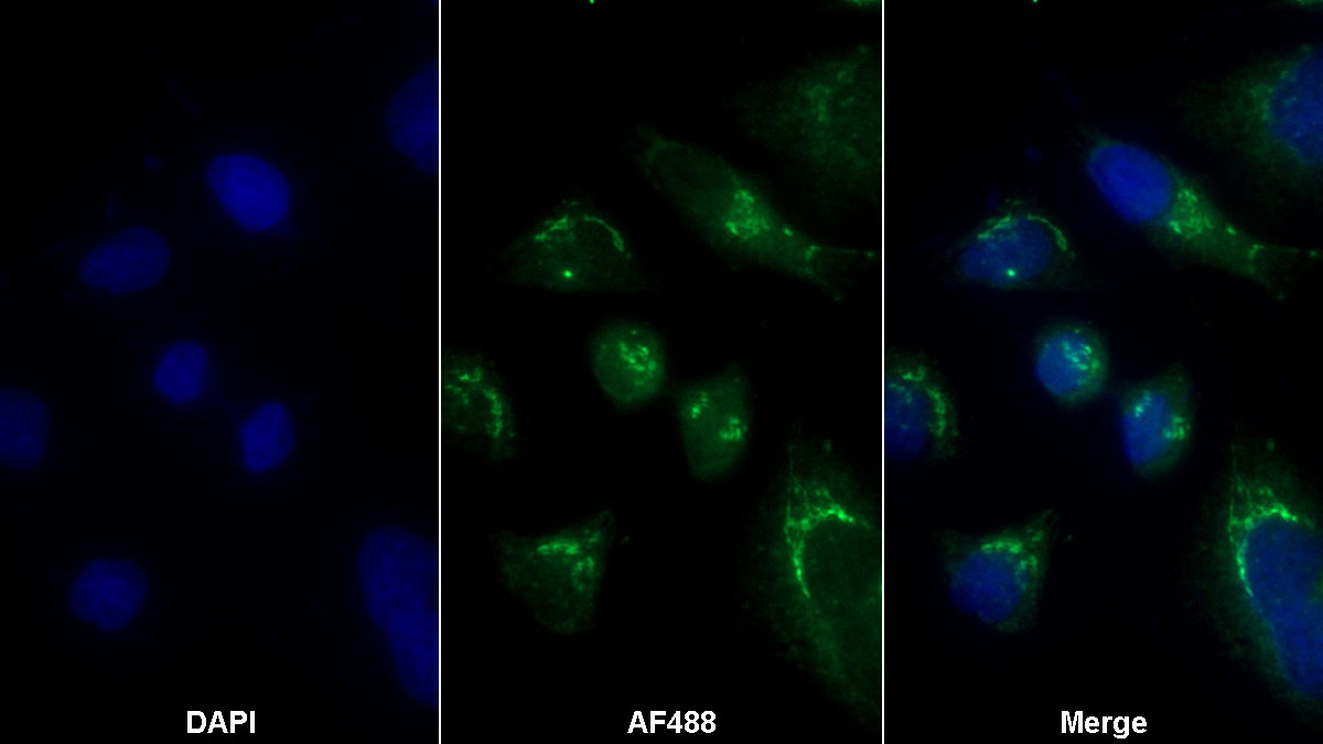 Polyclonal Antibody to Beta-1,4-Galactosyltransferase 1 (b4GALT1)