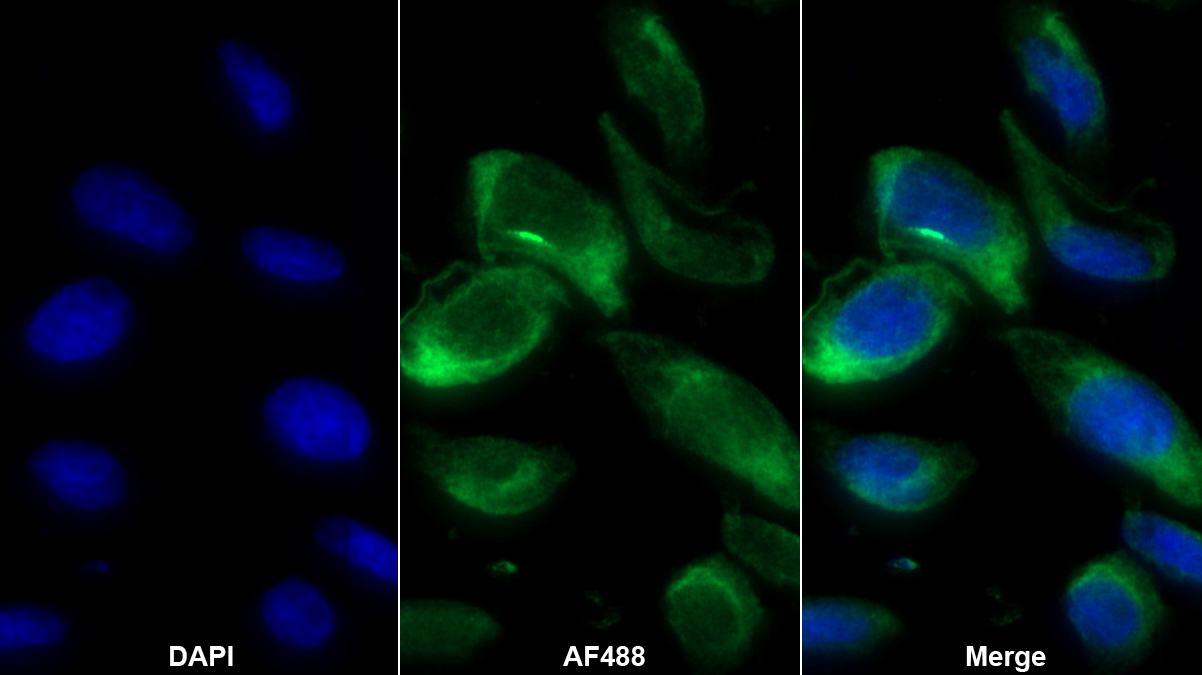 Polyclonal Antibody to Vascular Endothelial Growth Factor 121 (VEGF121)