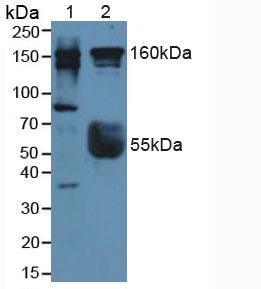 Polyclonal Antibody to Rho Associated Coiled Coil Containing Protein Kinase 2 (Rock2)