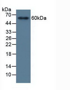 Polyclonal Antibody to Matrix Metalloproteinase 19 (MMP19)