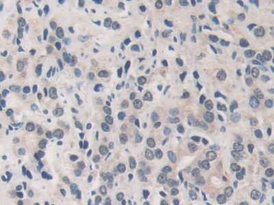 Polyclonal Antibody to Matrix Metalloproteinase 19 (MMP19)