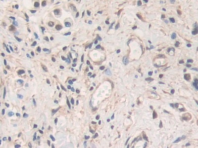 Polyclonal Antibody to Matrix Metalloproteinase 19 (MMP19)