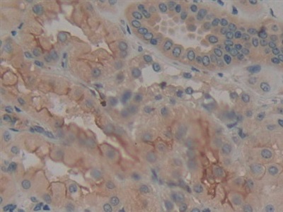 Polyclonal Antibody to Calumenin (CALU)