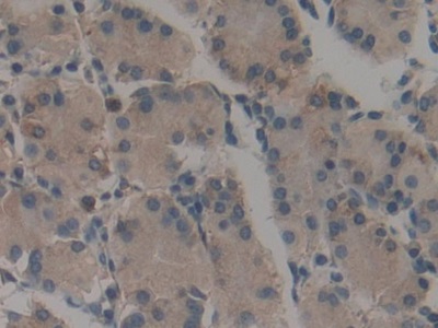 Polyclonal Antibody to Calumenin (CALU)