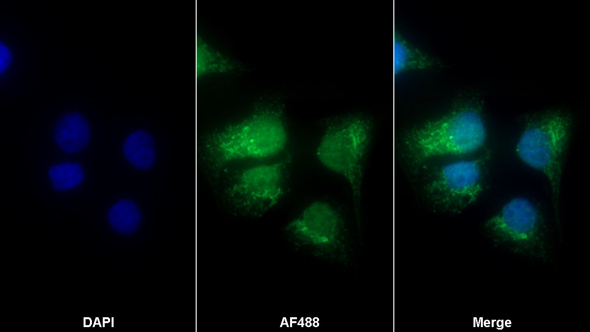 Polyclonal Antibody to Calumenin (CALU)