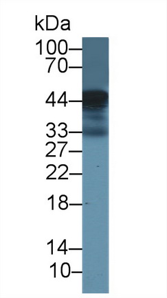 Polyclonal Antibody to Lectin Like Oxidized Low Density Lipoprotein Receptor 1 (LOX1)