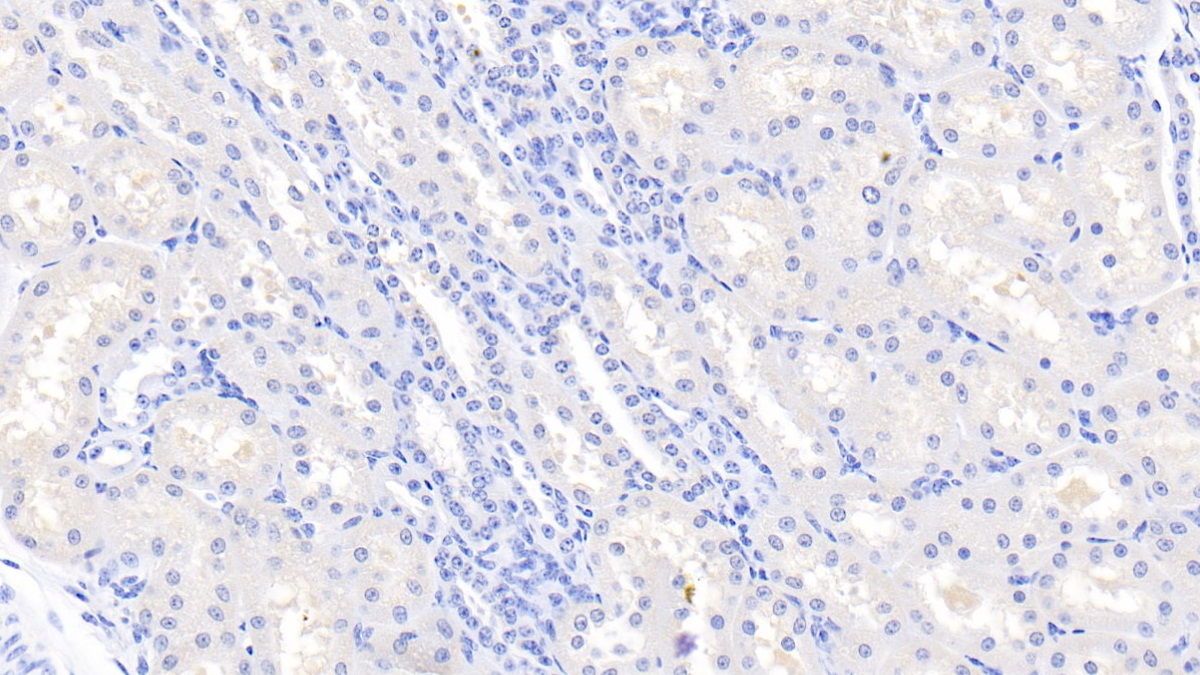 Polyclonal Antibody to Lectin Like Oxidized Low Density Lipoprotein Receptor 1 (LOX1)