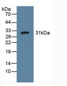 Polyclonal Antibody to Lectin Like Oxidized Low Density Lipoprotein Receptor 1 (LOX1)