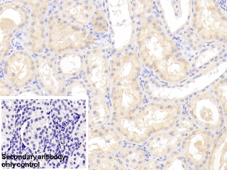 Polyclonal Antibody to Lectin Like Oxidized Low Density Lipoprotein Receptor 1 (LOX1)