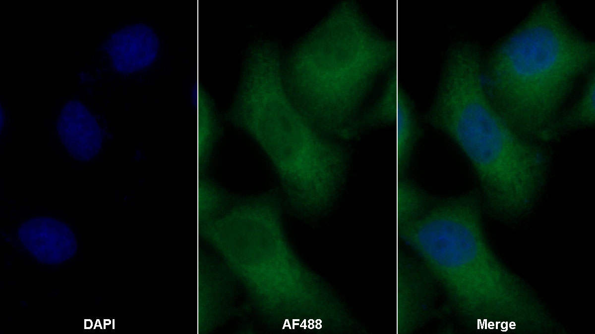 Polyclonal Antibody to Lectin Like Oxidized Low Density Lipoprotein Receptor 1 (LOX1)