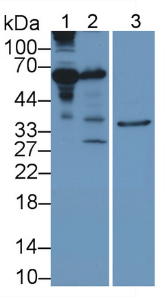 Polyclonal Antibody to Fetuin B (FETUB)