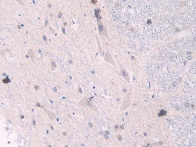 Polyclonal Antibody to Neuregulin 1 (NRG1)