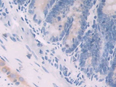 Polyclonal Antibody to Neuregulin 1 (NRG1)