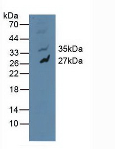 Polyclonal Antibody to Mitogen Activated Protein Kinase 10 (MAPK10)