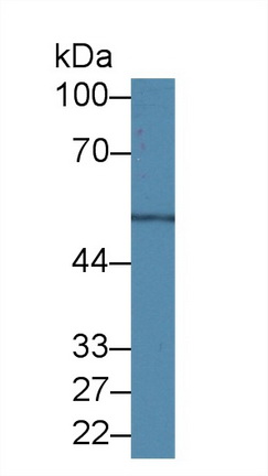 Polyclonal Antibody to Tubulin Beta (TUBb)