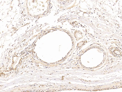 Polyclonal Antibody to Tubulin Beta (TUBb)