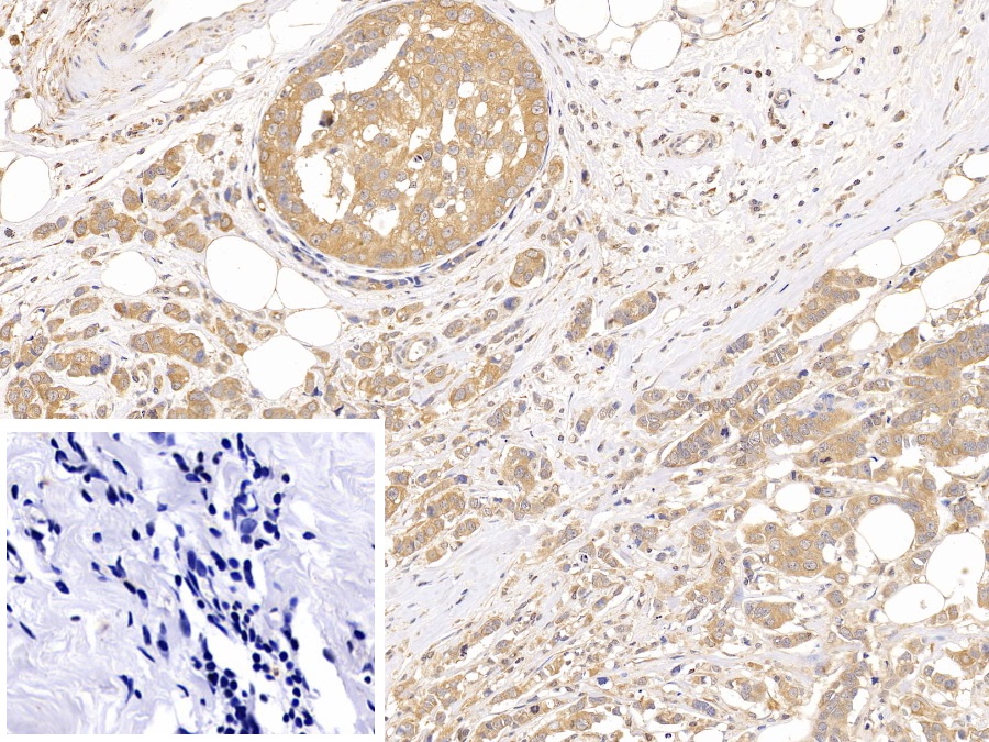 Polyclonal Antibody to Tubulin Beta (TUBb)