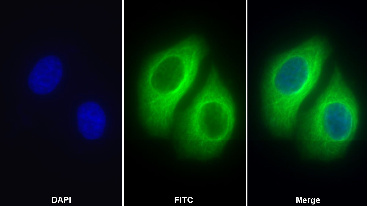 Polyclonal Antibody to Tubulin Beta (TUBb)