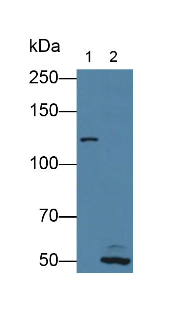 Polyclonal Antibody to Xeroderma Pigmentosum, Complementation Group G (XPG)