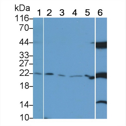 Polyclonal Antibody to Cluster Of Differentiation 3d (CD3d)