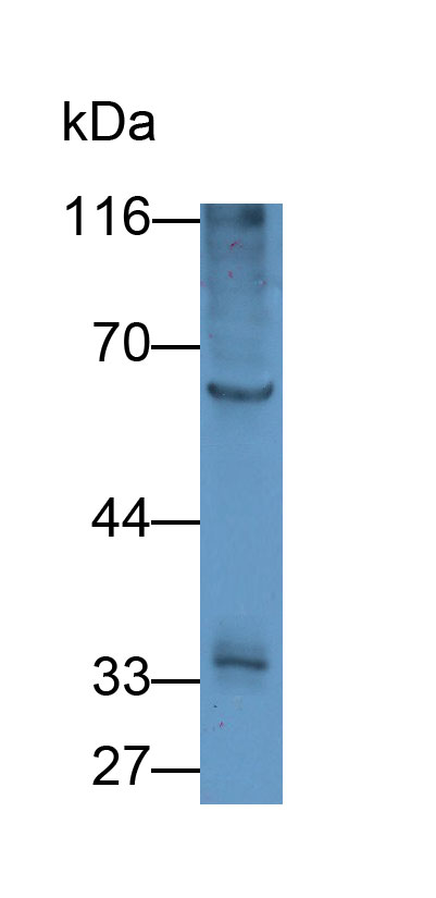 Polyclonal Antibody to Cluster Of Differentiation 19 (CD19)