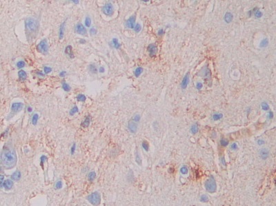 Polyclonal Antibody to Coagulation Factor VII (F7)