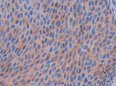 Polyclonal Antibody to Coagulation Factor VII (F7)