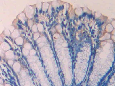 Polyclonal Antibody to Coagulation Factor VII (F7)