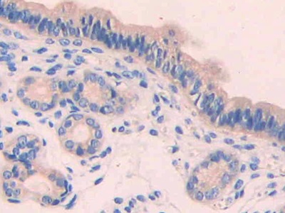 Polyclonal Antibody to Coagulation Factor VII (F7)