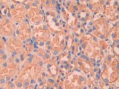 Polyclonal Antibody to Coagulation Factor VII (F7)