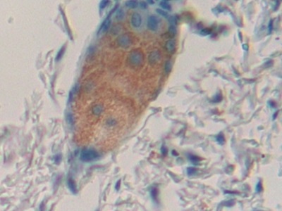 Polyclonal Antibody to Coagulation Factor VII (F7)