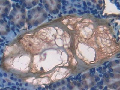 Polyclonal Antibody to Coagulation Factor VII (F7)