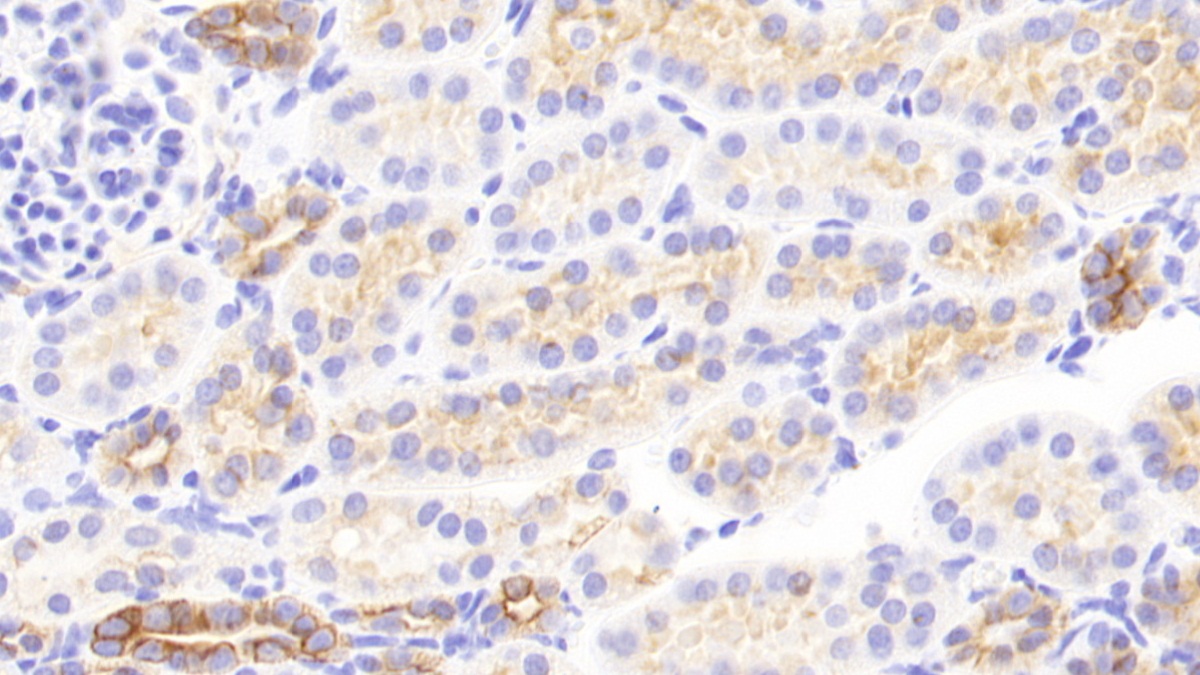 Polyclonal Antibody to Cytokeratin 13 (CK13)