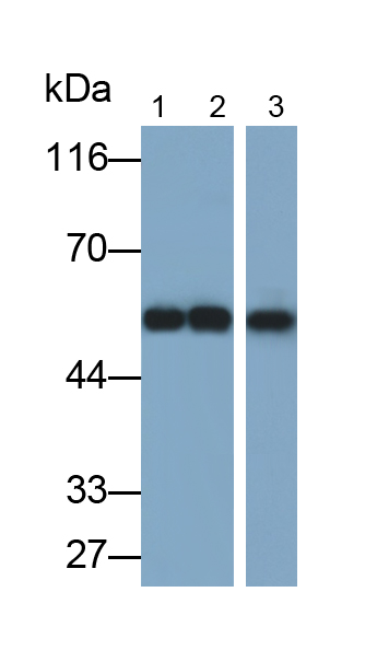 Polyclonal Antibody to Cytokeratin 13 (CK13)