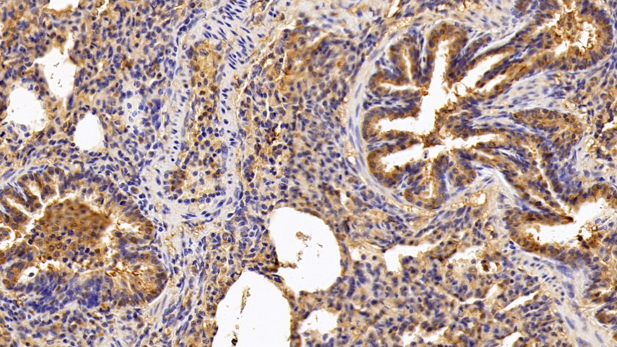 Polyclonal Antibody to Coagulation Factor VIII (F8)