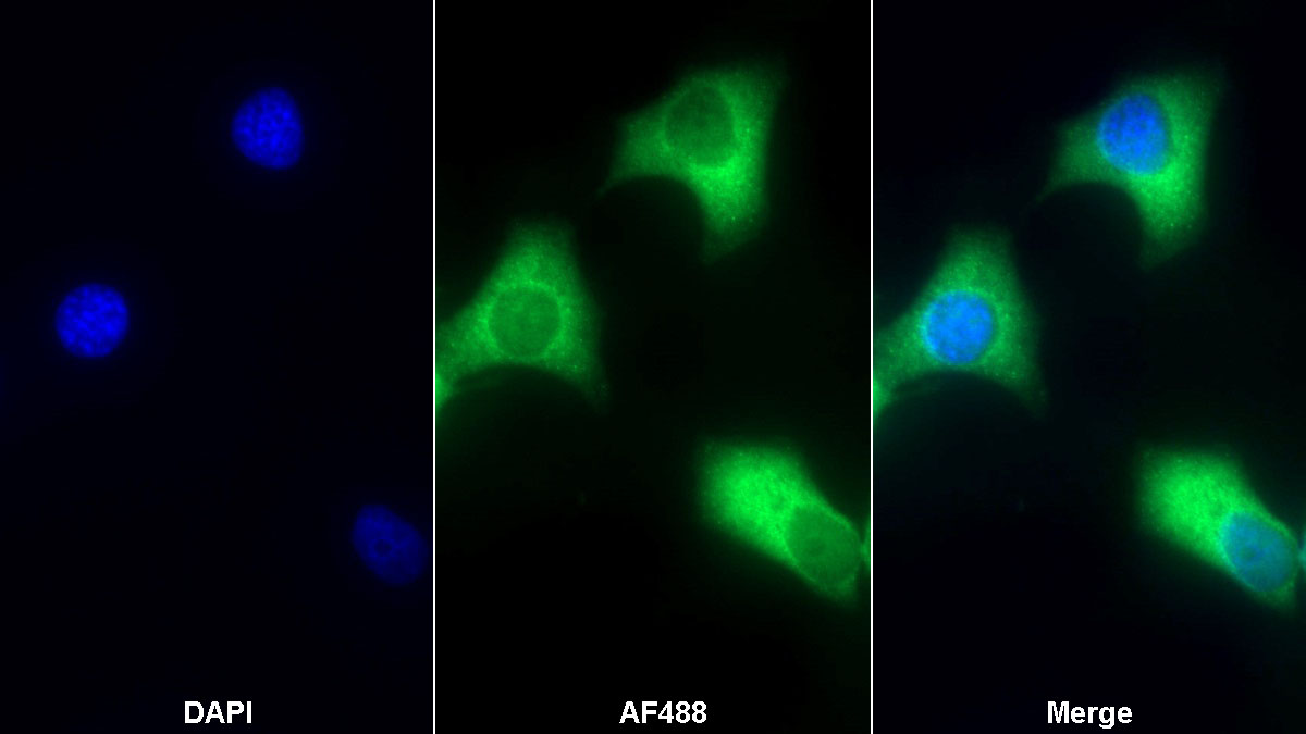 Polyclonal Antibody to Coagulation Factor VIII (F8)