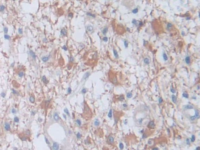 Polyclonal Antibody to Coagulation Factor VIII (F8)