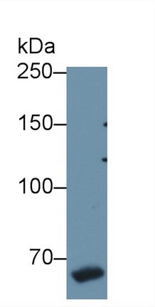 Polyclonal Antibody to Coagulation Factor VIII (F8)