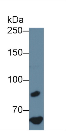 Polyclonal Antibody to Coagulation Factor VIII (F8)