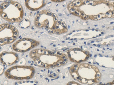 Polyclonal Antibody to Fibroblast Growth Factor 10 (FGF10)