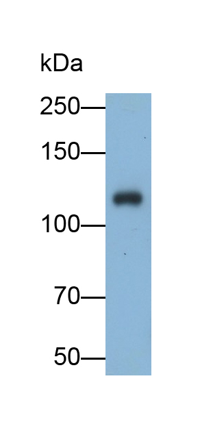 Polyclonal Antibody to Angiotensin I Converting Enzyme 2 (ACE2)