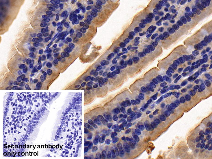 Polyclonal Antibody to Angiotensin I Converting Enzyme 2 (ACE2)