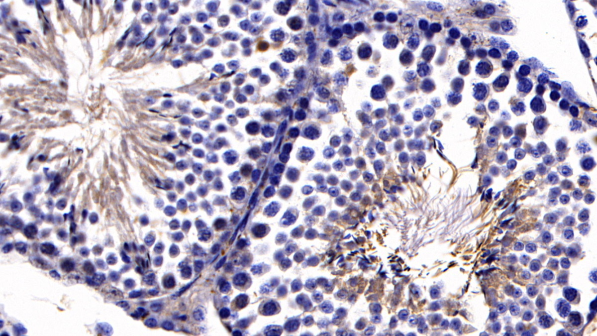 Polyclonal Antibody to Angiotensin I Converting Enzyme 2 (ACE2)