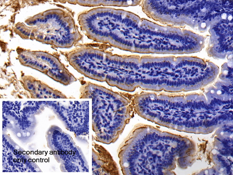 Polyclonal Antibody to Angiotensin I Converting Enzyme 2 (ACE2)