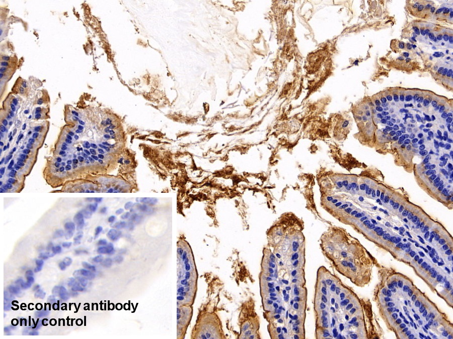 Polyclonal Antibody to Angiotensin I Converting Enzyme 2 (ACE2)