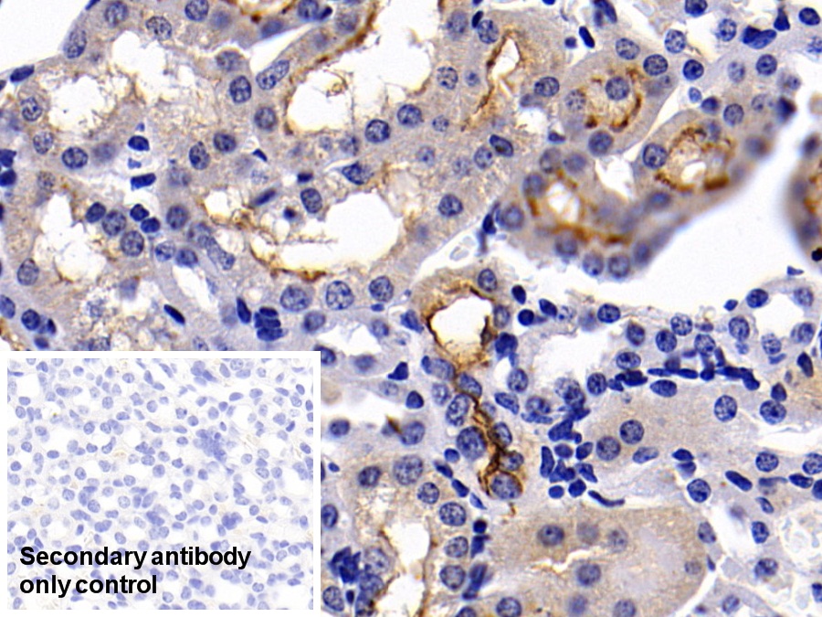 Polyclonal Antibody to Angiotensin I Converting Enzyme 2 (ACE2)